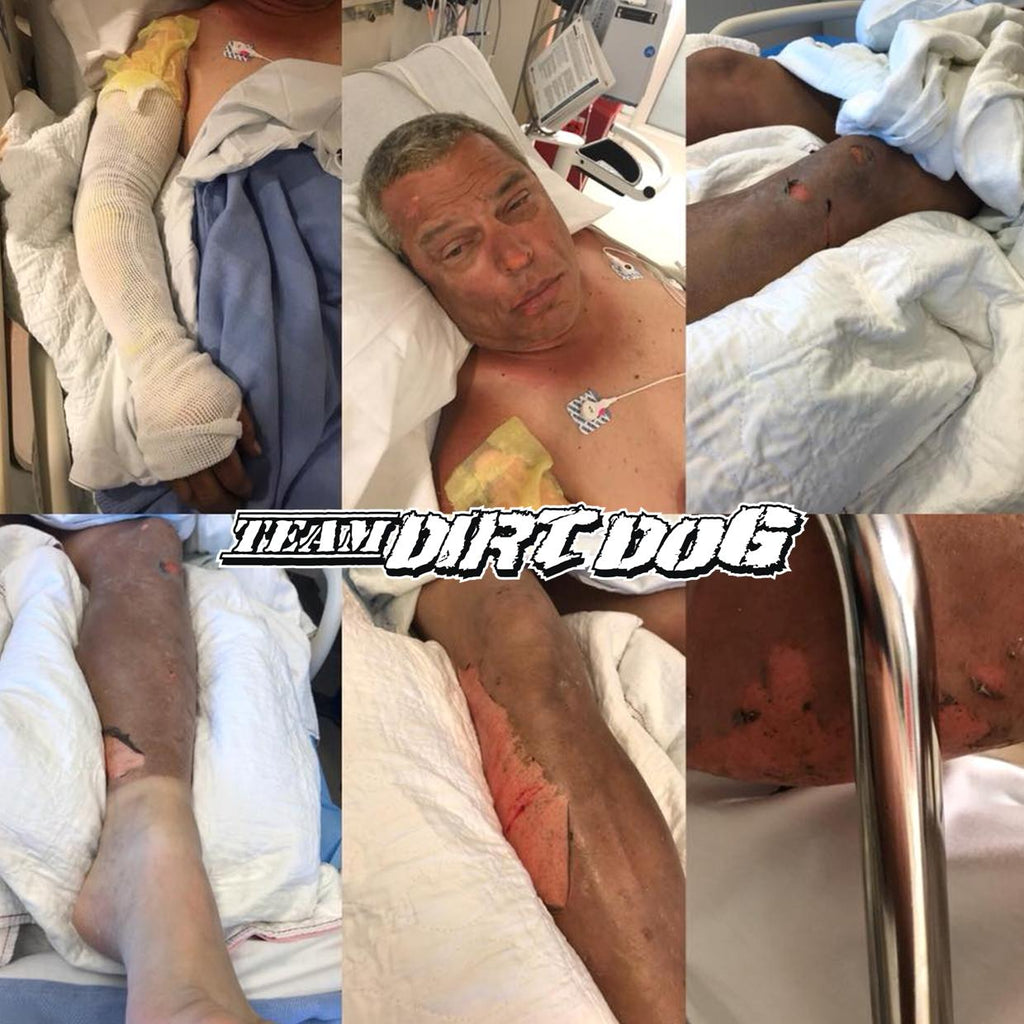 Mom & Dad BURNED in Pit Fire Need Our Help! PLEASE SHARE & DONATE